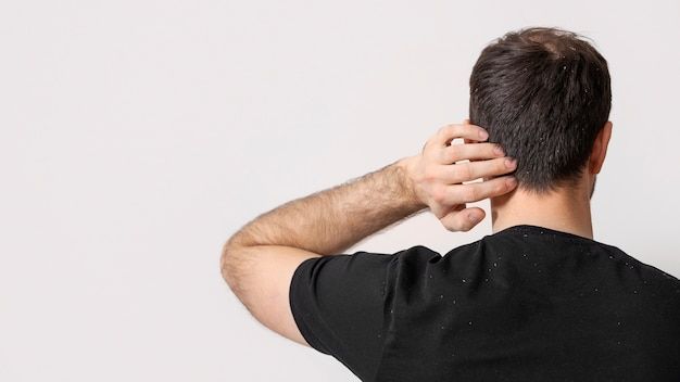 Forfora: cause, rimedi e routine per capelli con desquamazione